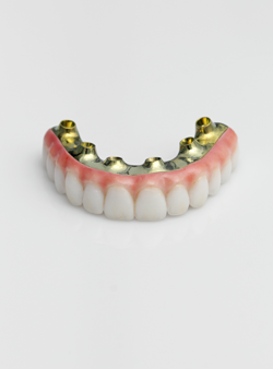 AOX implants